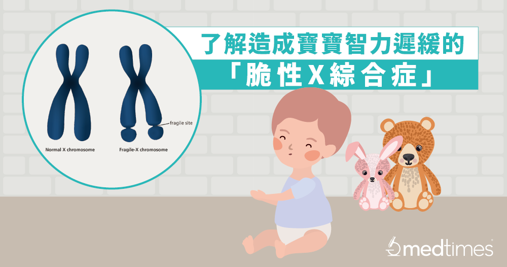【遺傳疾病】了解造成寶寶智力遲緩的「脆性X綜合症」